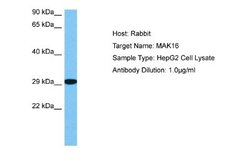 MAK16 Antibody, Novus Biologicals 100 &mu;L; Unconjugated:Antibodies, Polyclonal